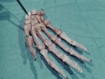 The Palmar Hand, Part I: Orientation by Teaching Film, Inc.